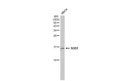 SOD1/Cu-Zn SOD Antibody (HL1652) - Azide and BSA Free, Novus Biologicals