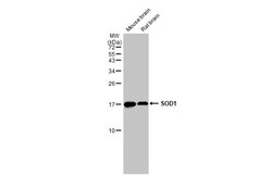 SOD1/Cu-Zn SOD Antibody (HL1652) - Azide and BSA Free, Novus Biologicals