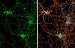 Stargazin Antibody (HL2268) - Azide and BSA Free, Novus Biologicals 100