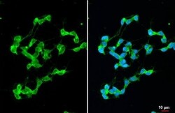 Stargazin Antibody (HL2268) - Azide and BSA Free, Novus Biologicals 100