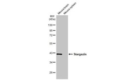 Stargazin Antibody (HL2268) - Azide and BSA Free, Novus Biologicals 100