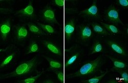 SUN1 Antibody (HL1946) - Azide and BSA Free, Novus Biologicals 100 &mu;L,