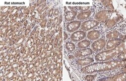 TBC1D5 Antibody (HL2054) - Azide and BSA Free, Novus Biologicals 100 &mu;L,