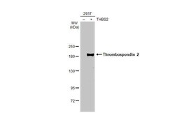 Thrombospondin-2 Antibody (HL1194) - Azide and BSA Free, Novus Biologicals 100 &mu;L | Buy Online | Novus Biologicals | Fisher Scientific