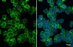 TREM2 Antibody (HL1738) - Azide and BSA Free, Novus Biologicals 100 &mu;L,