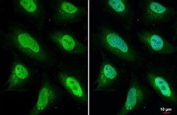 ULK2 Antibody (HL2206) - Azide and BSA Free, Novus Biologicals 100 &mu;L,