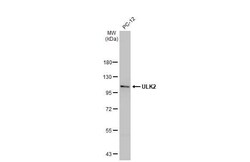 ULK2 Antibody (HL2206) - Azide and BSA Free, Novus Biologicals 100 &mu;L,
