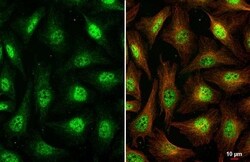 Virilizer Antibody (HL1719) - Azide and BSA Free, Novus Biologicals 100