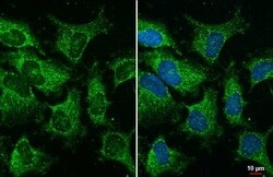 YTHDC2 Antibody (HL1862) - Azide and BSA Free, Novus Biologicals 100 &mu;L,
