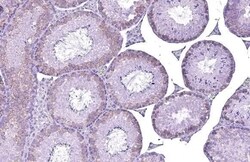 YTHDC2 Antibody (HL1862) - Azide and BSA Free, Novus Biologicals 100 &mu;L,
