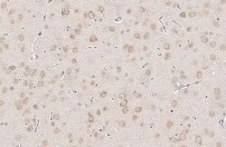 YTHDF3 Antibody (HL2235) - Azide and BSA Free, Novus Biologicals 100 &mu;L | Buy Online | Novus Biologicals | Fisher Scientific