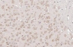 YTHDF3 Antibody (HL2235) - Azide and BSA Free, Novus Biologicals 100 &mu;L | Buy Online | Novus Biologicals | Fisher Scientific