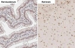 ZEB1 Antibody (HL2245) - Azide and BSA Free, Novus Biologicals 100 &mu;L,