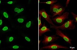 ZEB1 Antibody (HL2245) - Azide and BSA Free, Novus Biologicals 100 &mu;L,
