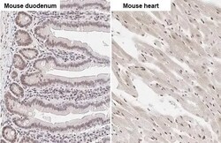 ZEB1 Antibody (HL2245) - Azide and BSA Free, Novus Biologicals 100 &mu;L,