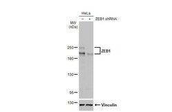 ZEB1 Antibody (HL2245) - Azide and BSA Free, Novus Biologicals 100 &mu;L,