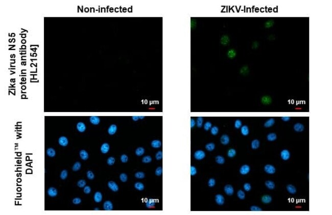 Zika virus NS5 Antibody (HL2154) - Azide and BSA Free, Novus ...