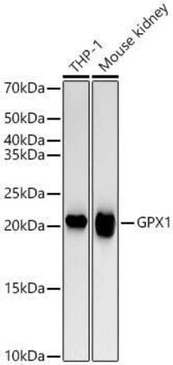 Glutathione Peroxidase 1/GPX1 Antibody (ARC53251), Novus Biologicals 20 &mu;L | Buy Online | Novus Biologicals | Fisher Scientific