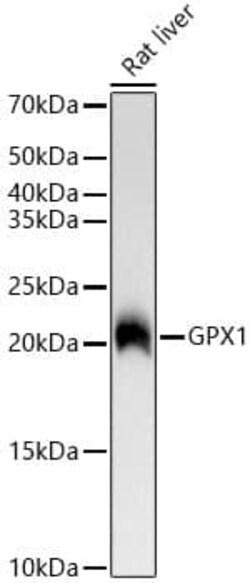 Glutathione Peroxidase 1/GPX1 Antibody (ARC53251), Novus Biologicals 20 &mu;L | Buy Online | Novus Biologicals | Fisher Scientific