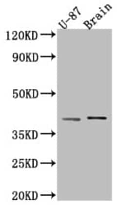 beta-NGF Antibody (5F10), Novus Biologicals:Antibodies:Primary Antibodies