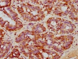 NDRG1 Antibody (4C8), Novus Biologicals:Antibodies:Primary Antibodies