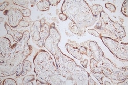 NAIP Antibody (13E6), Novus Biologicals 100 &mu;L | Buy Online | Novus Biologicals | Fisher Scientific