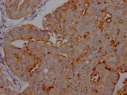 CA125/MUC16 Antibody (10E9), Novus Biologicals:Antibodies:Primary Antibodies