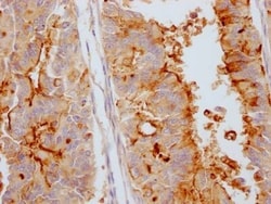 CA125/MUC16 Antibody (10F10), Novus Biologicals:Antibodies:Primary Antibodies