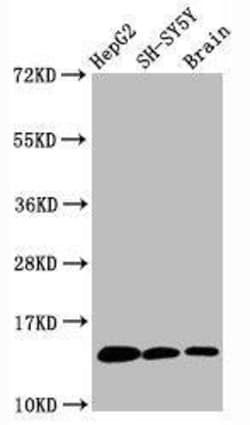 Histone H3.1, Monomethyl Lys36 Antibody (1F4), Novus Biologicals 50 &mu;L;
