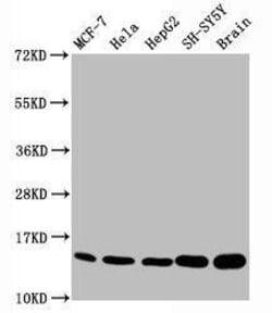 Histone H3.1, Monomethyl Lys18 Antibody (2B5), Novus Biologicals:Antibodies:Primary
