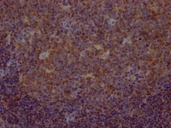 Methionine Aminopeptidase 2/METAP2 Antibody (8F2), Novus Biologicals 100