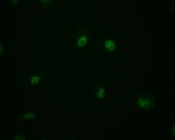 MBD1 Antibody (10B10), Novus Biologicals 50 &mu;L; Unconjugated:Antibodies,