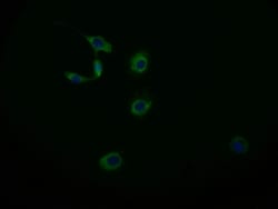 MAS1L Antibody (15B8), Novus Biologicals:Antibodies:Primary Antibodies