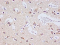JNK3 Antibody (29E10), Novus Biologicals 50 &mu;L; Unconjugated:Antibodies,