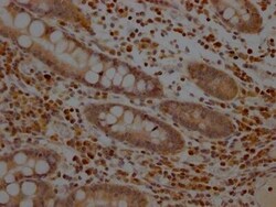 MEK1 Antibody (3F10), Novus Biologicals 100 &mu;L; Unconjugated:Antibodies,