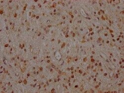 MEK1 Antibody (9B6), Novus Biologicals:Antibodies:Primary Antibodies