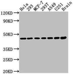 MEK1 Antibody (9B6), Novus Biologicals:Antibodies:Primary Antibodies