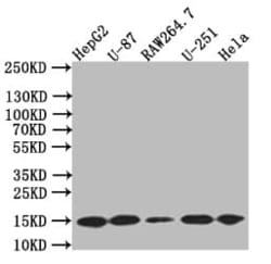 LC3B Antibody (7D11), Novus Biologicals:Antibodies:Primary Antibodies