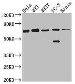 Leukotriene A4 Hydrolase/LTA4H Antibody (6G7), Novus Biologicals:Antibodies:Primary