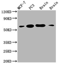 Lysyl Oxidase Homolog 2/LOXL2 Antibody (2E5), Novus Biologicals 50 &mu;L;