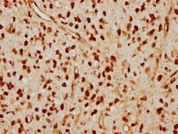 Lamin A + C Antibody (4H7), Novus Biologicals:Antibodies:Primary Antibodies