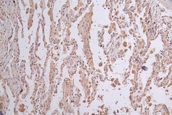 Lgr6 Antibody (15G3), Novus Biologicals:Antibodies:Primary Antibodies