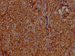 LDLR Antibody (2B10), Novus Biologicals 50 &mu;L; Unconjugated:Antibodies,