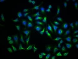 LDLR Antibody (2B10), Novus Biologicals 50 &mu;L; Unconjugated:Antibodies,