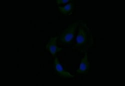Cytokeratin 6a Antibody (21E2), Novus Biologicals:Antibodies:Primary Antibodies