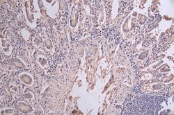 Cytokeratin 20 Antibody (17A11), Novus Biologicals 100 &mu;L; Unconjugated:Antibodies,