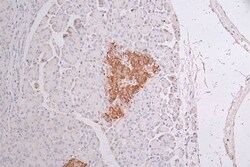 Cytokeratin 10 Antibody (18B6), Novus Biologicals 100 &mu;L; Unconjugated:Antibodies,