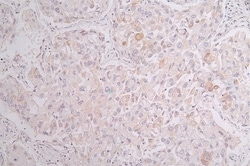 Cytokeratin 10 Antibody (18B6), Novus Biologicals 100 &mu;L; Unconjugated:Antibodies,