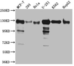 Eg5 Antibody (1G11), Novus Biologicals:Antibodies:Primary Antibodies