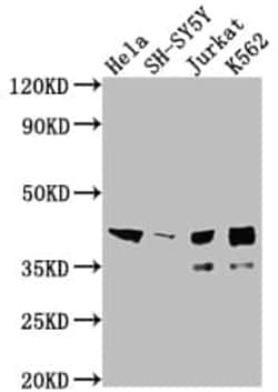 Islet-1 Antibody (4F6), Novus Biologicals 50 &mu;L; Unconjugated:Antibodies,